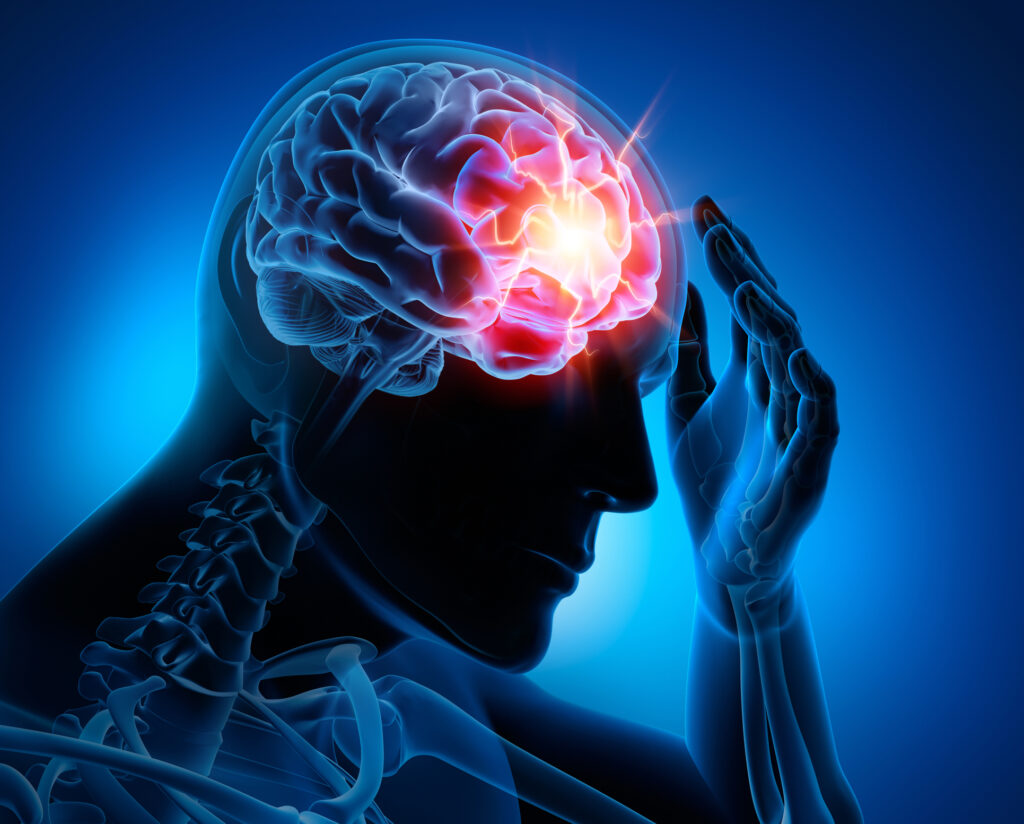 Zavodnick & Lasky Personal Injury Lawyers | Wilmington Brain Injury Attorney Is Cerebral Palsy a Result of Medical Malpractice?