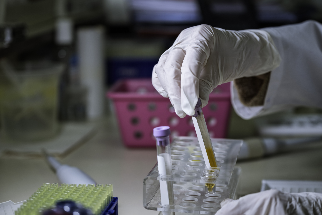 Drug Testing for Workers’ Compensation Benefits