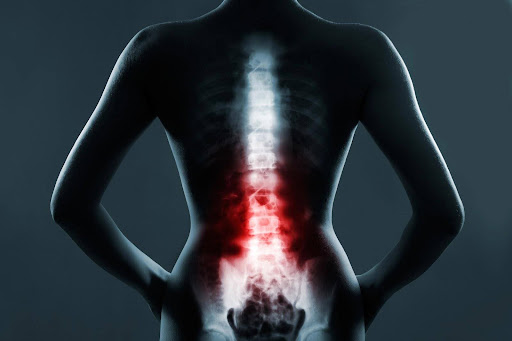 An X-ray image of a spine with red highlights, representing spinal cord injuries. An X-ray image of a spine with red highlights, representing spinal cord injuries.